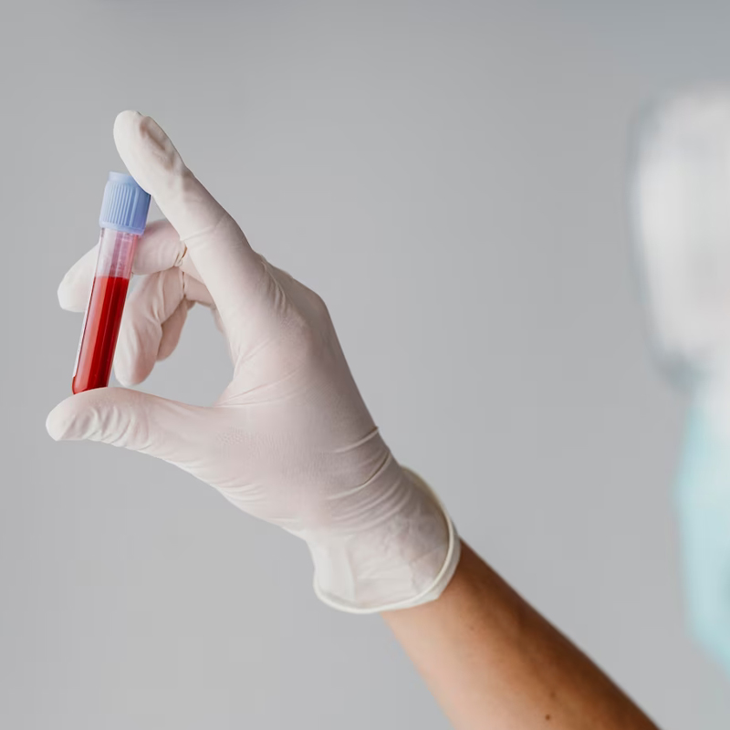 Análisis clínicos Farmacia Motilla Villar en Valencia